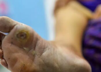 Body में बढ़ जाती है suger तो दिखते हैं डायबिटीज के ये 4 शुरुआती लक्षण, नजरअंदाज करने की ना करें गलती