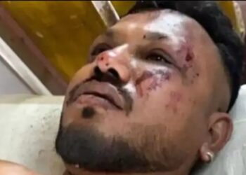 जाको राखे साईंया……अहमदाबाद विमान हादसे में चमत्कार, मौत के मुंह से जिंदा लौटे 2 लोग