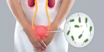 UTI क्या है? इसमें कैसे होता है इन्फेक्शन, एक्सपर्ट से जानें इसके कारण, लक्षण और कैसे करें इलाज